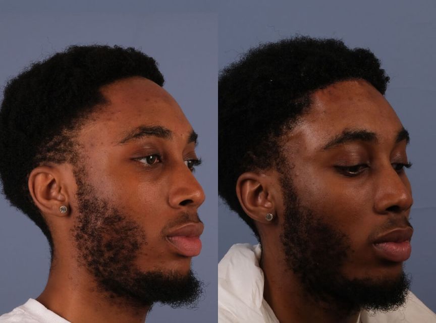 b&a1