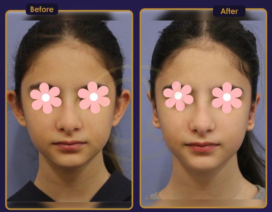 b&a3
